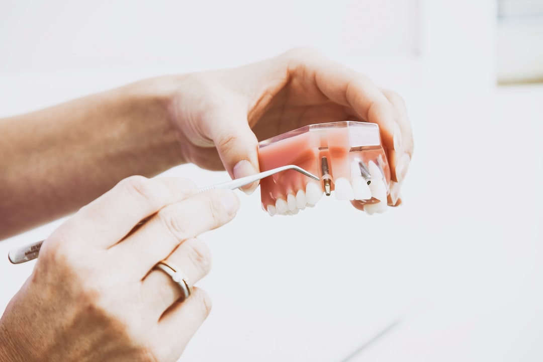 Longevity of Dental Implants: How Long Do They Last?